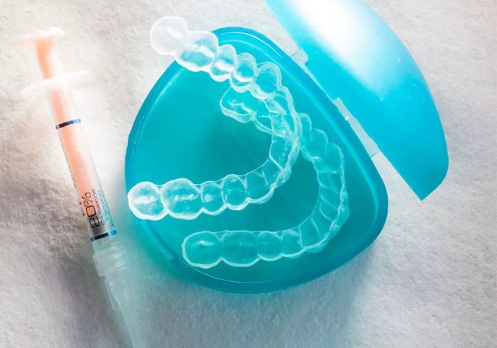 Whiten Teeth With Hydrogen Peroxide
