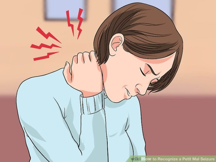 How to Recognize a Petit Mal Seizure: 12 Steps (with Pictures) Recognize a Petit Mal Seizure