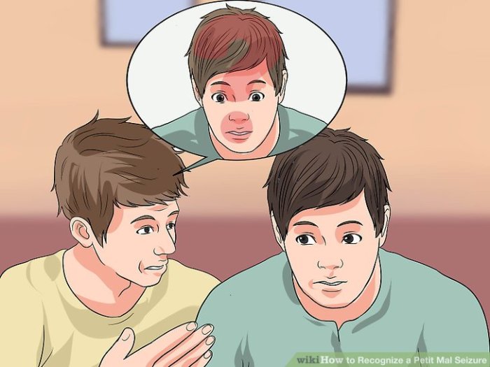 How to Recognize a Petit Mal Seizure: 12 Steps (with Pictures) Recognize a Petit Mal Seizure