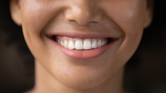 Whiten Teeth With Hydrogen Peroxide A Guide